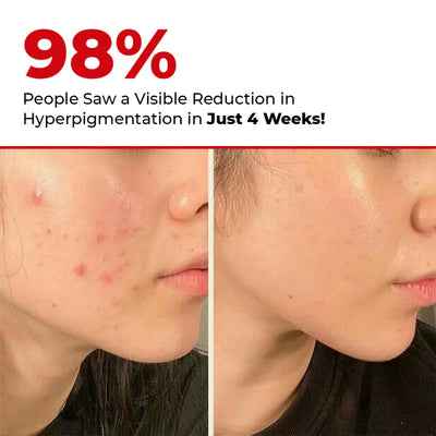 5 Antioxidant Serum Mini