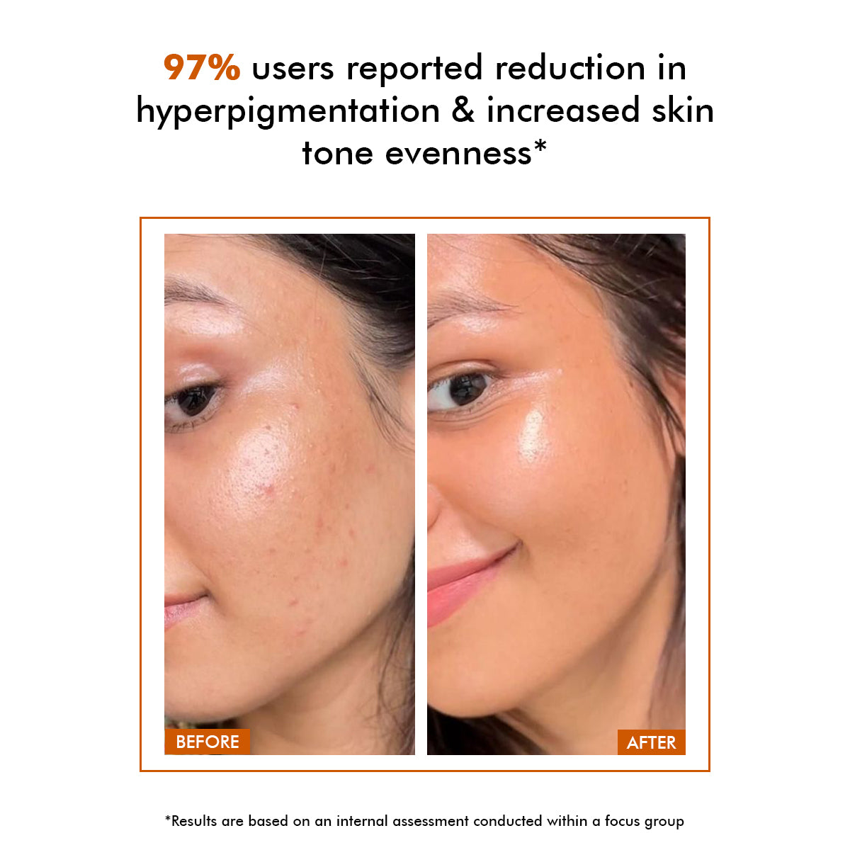 Vivid C | 10% Vitamin C Skin Brightening Serum
