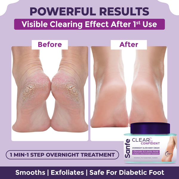 Sanfe Overnight Cream