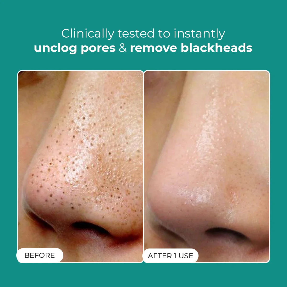 Blackhead Melting Water mini | Flash Sale