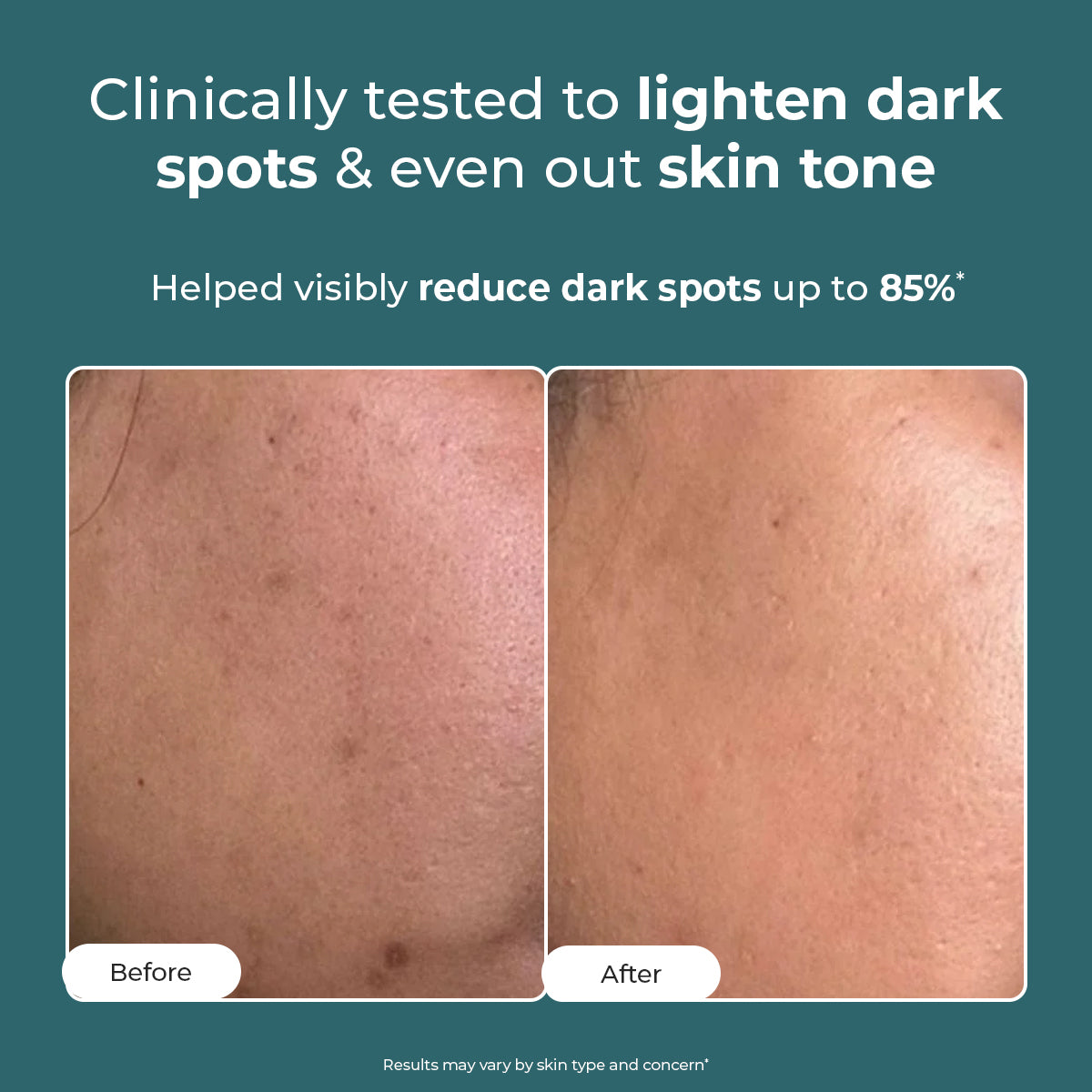 Conscious Chemist Pigmentation Removal Cream | Kojic, Azelaic & Tranexamic Acid | For Dark Spots (50 g)