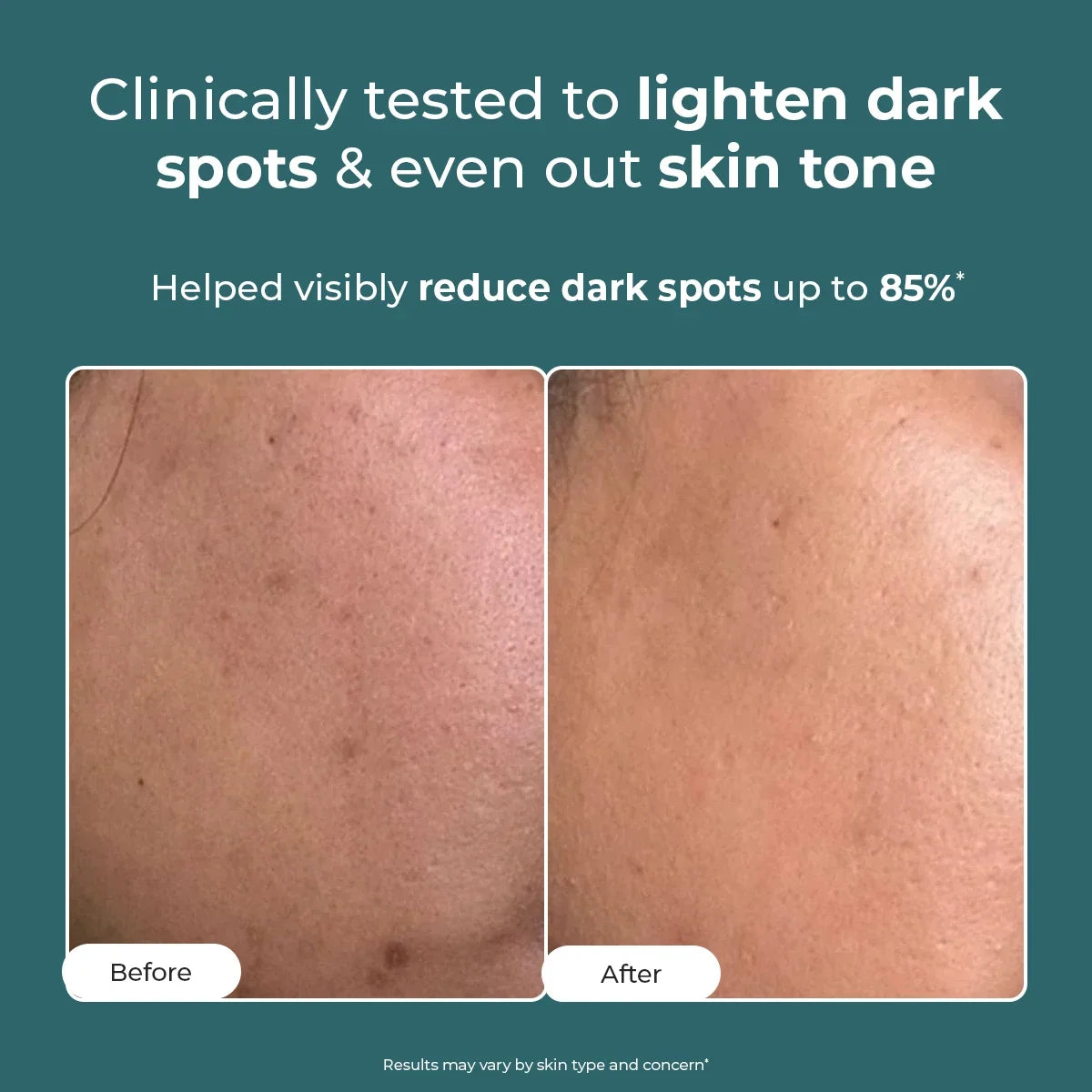 Trubiom Pigmentation Corrector Gel Cream