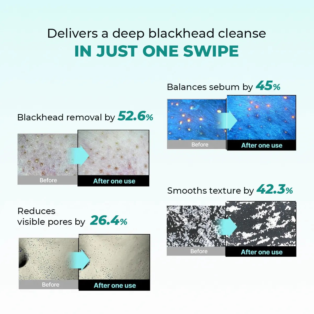 Blackhead Melting Water mini | Flash Sale