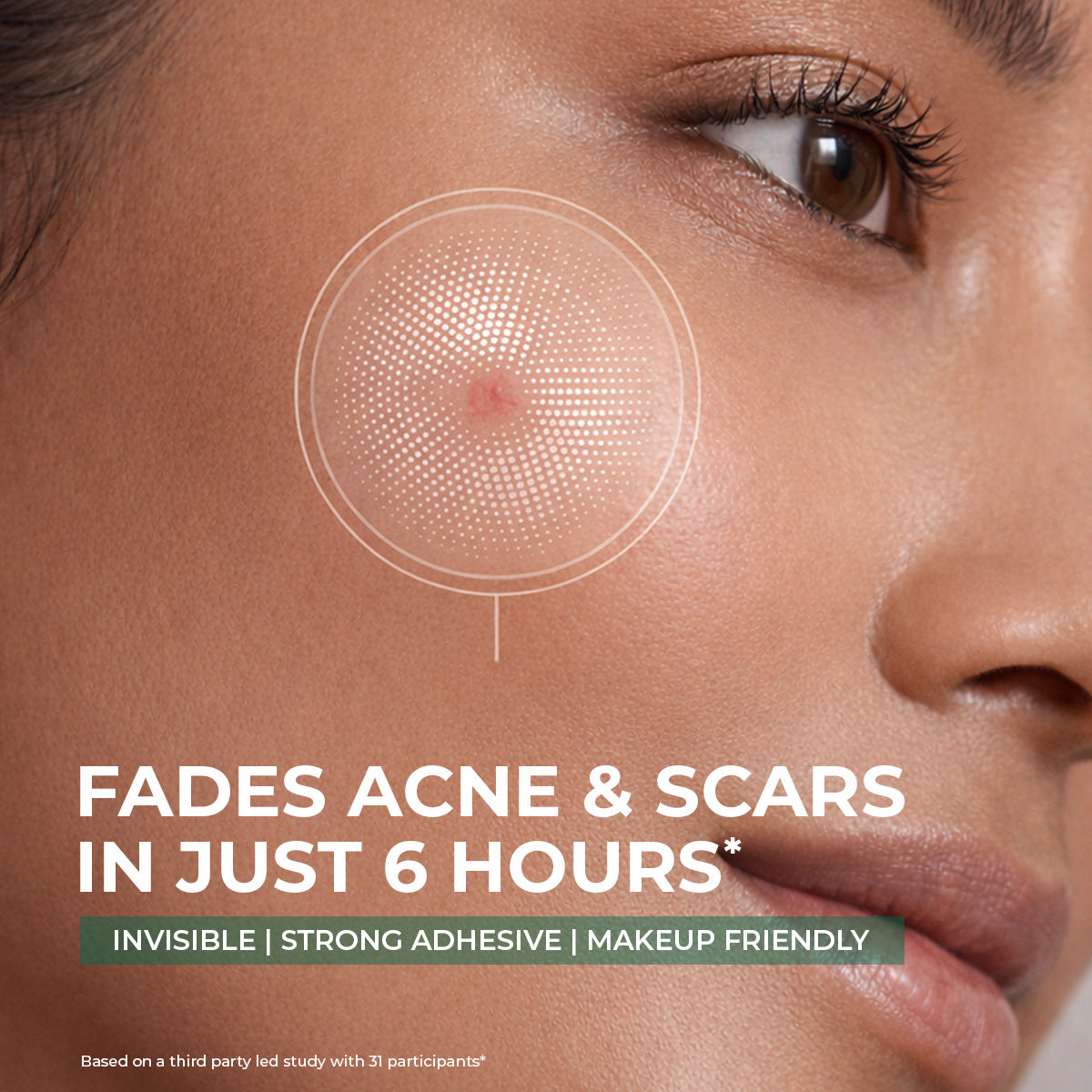Conscious Chemist Self Dissolving Microneedle Acne Patches | Kills Bacteria & Reduces Redness