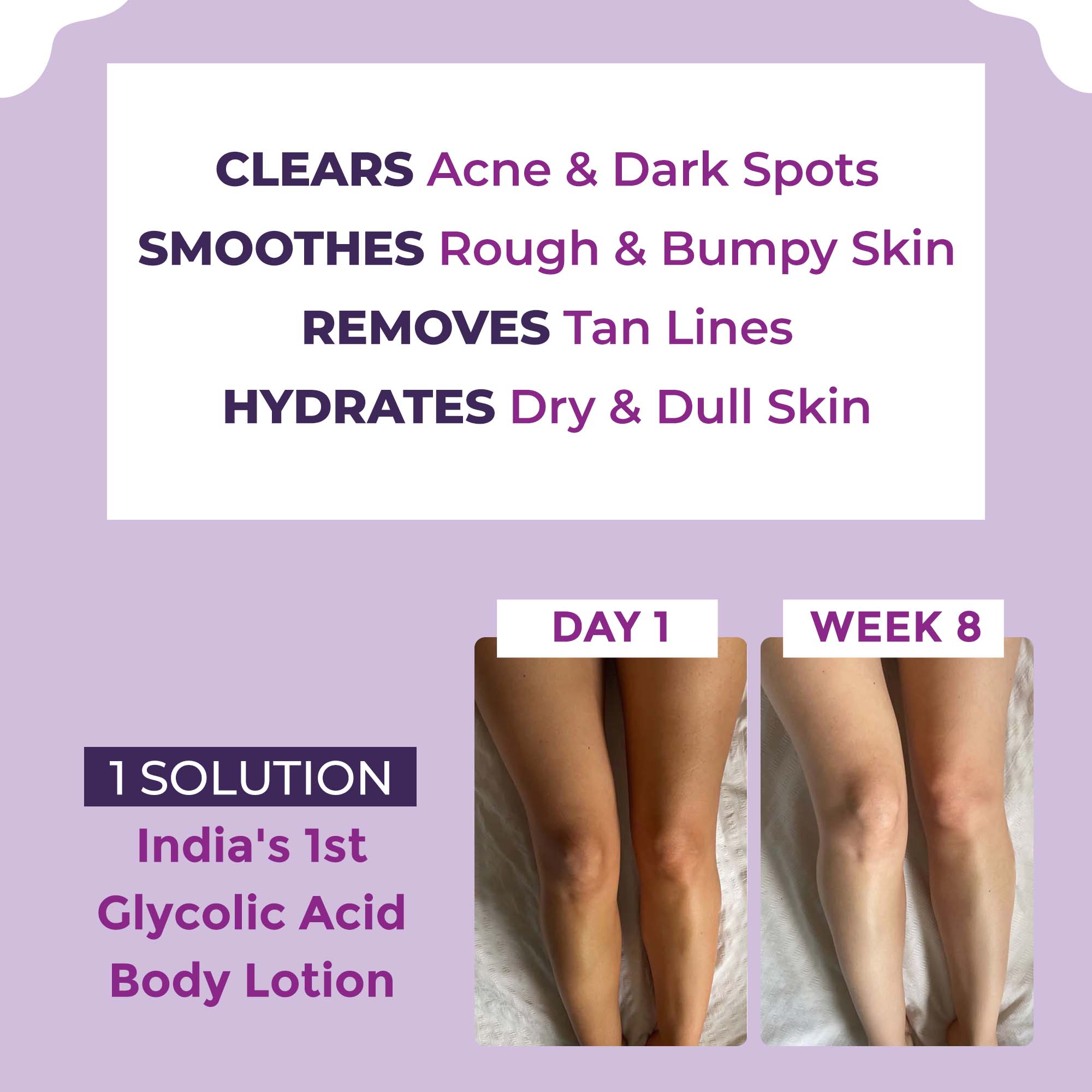 Sanfe Clear & Confident Glycolic Acid Body Lotion