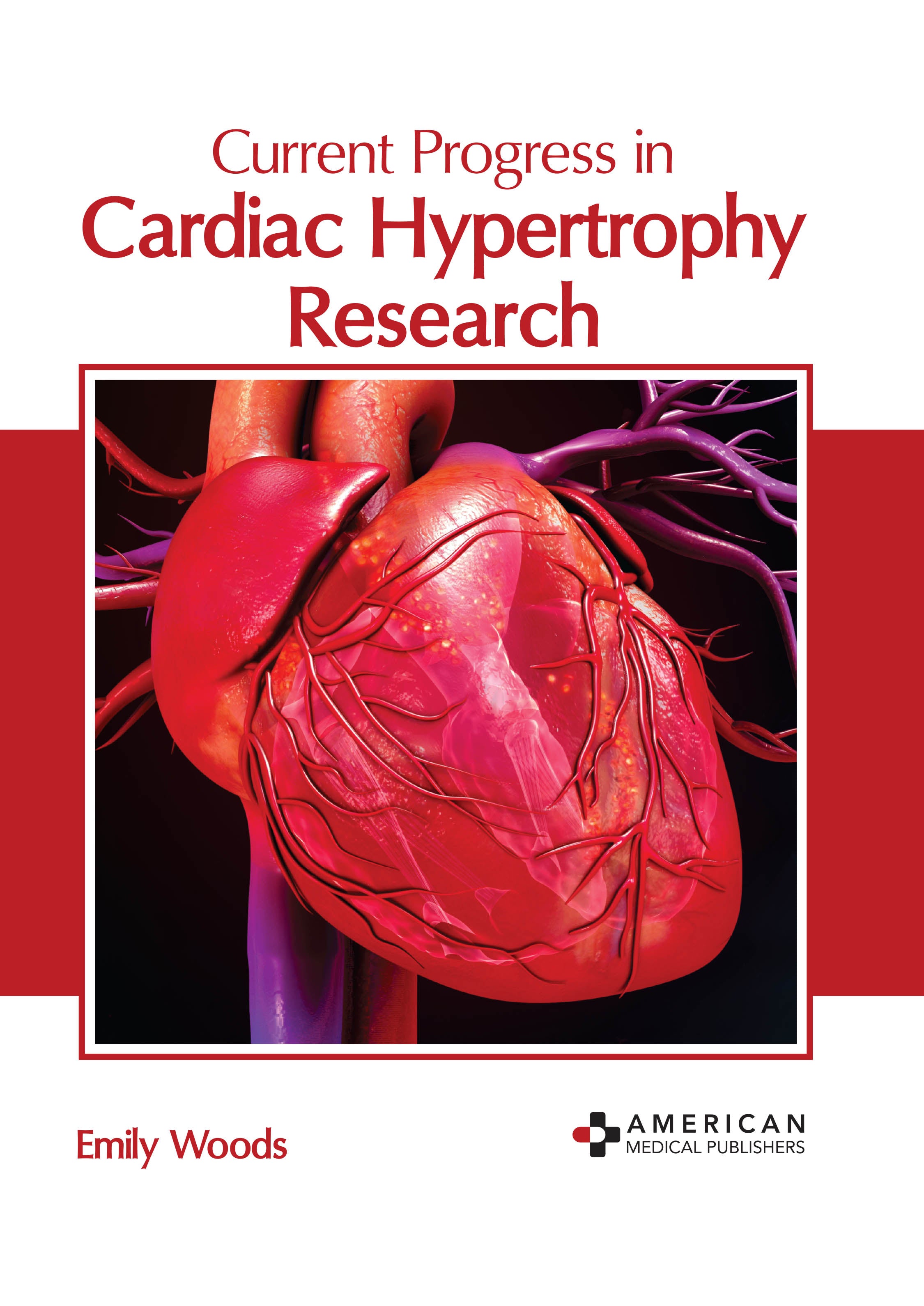 Current Progress in Cardiac Hypertrophy Research - Prints Publications