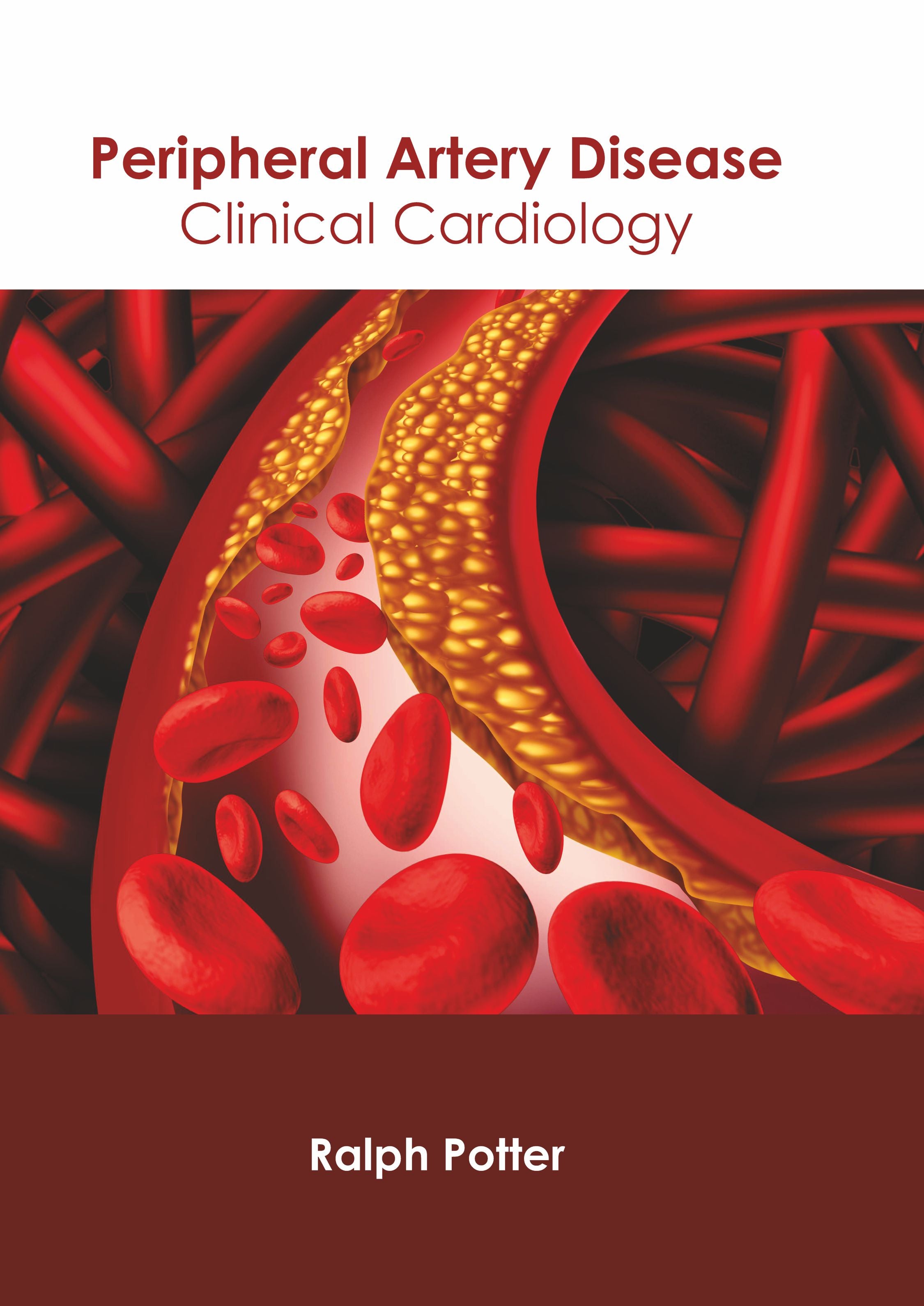 Peripheral Artery Disease: Clinical Cardiology - Prints Publications