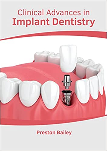 Clinical Advances in Implant Dentistry - Prints Publications