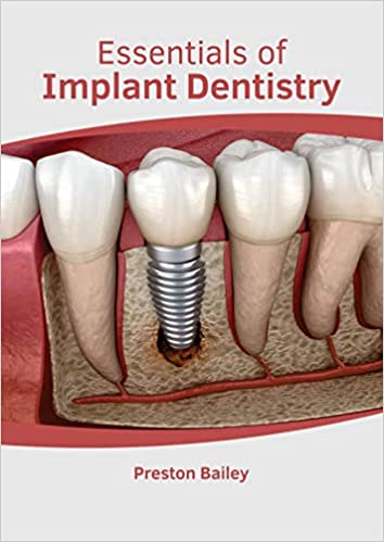 Essentials of Implant Dentistry - Prints Publications