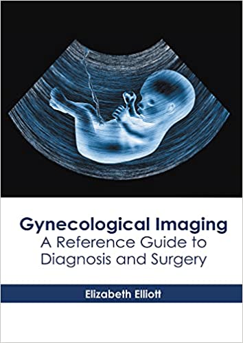 Gynecological Imaging: A Reference Guide to Diagnosis and Surgery - Prints Publications