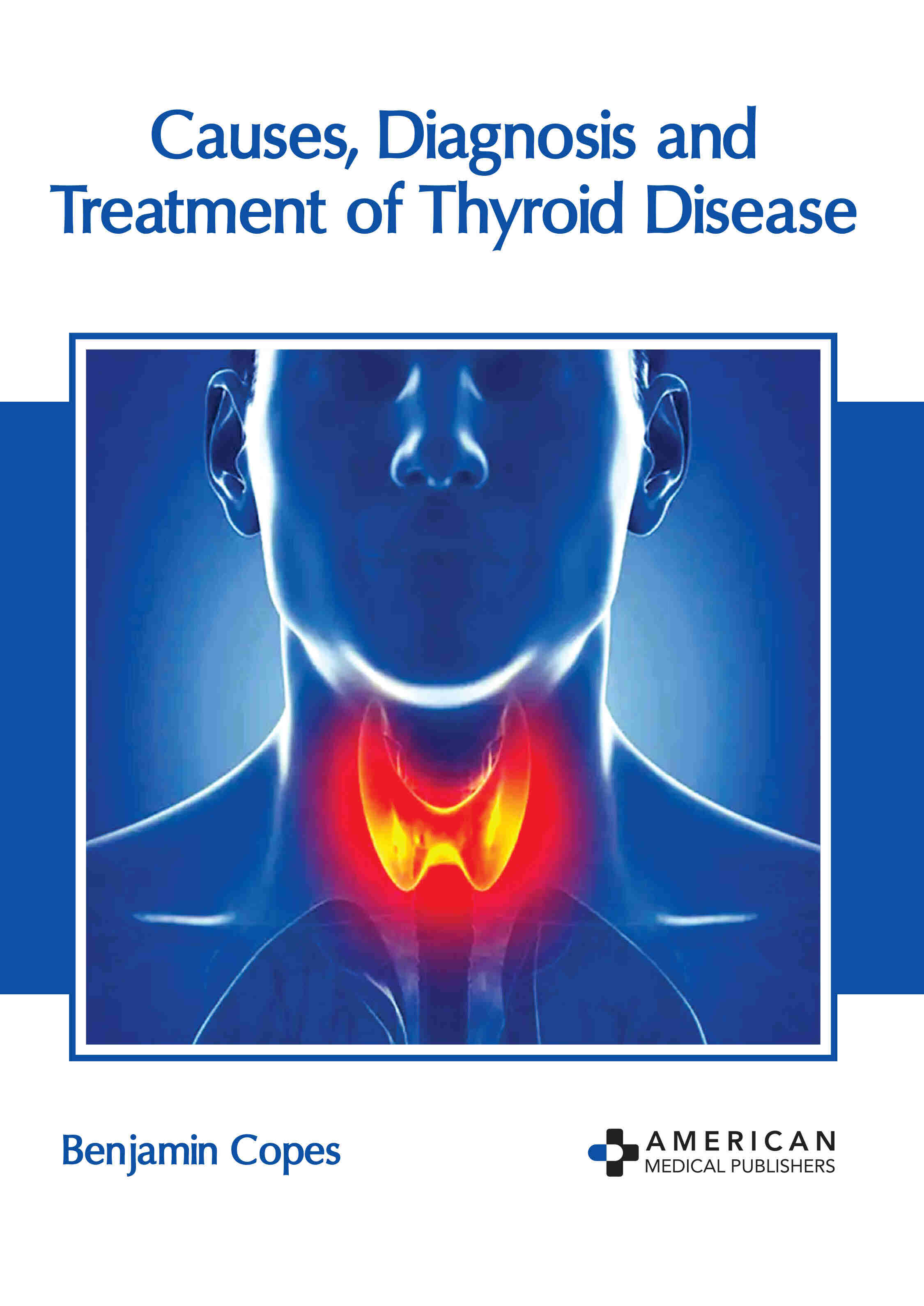 Causes, Diagnosis and Treatment of Thyroid Disease - Prints Publications