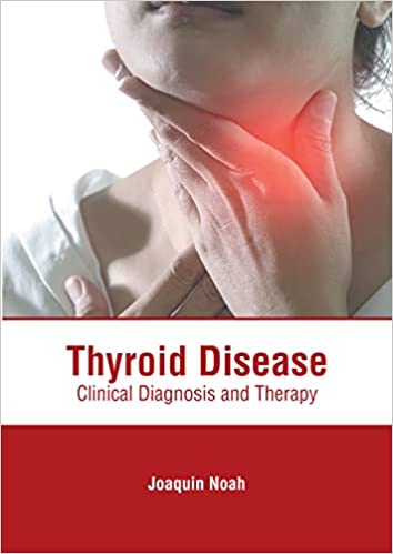 Thyroid Disease: Clinical Diagnosis and Therapy - Prints Publications