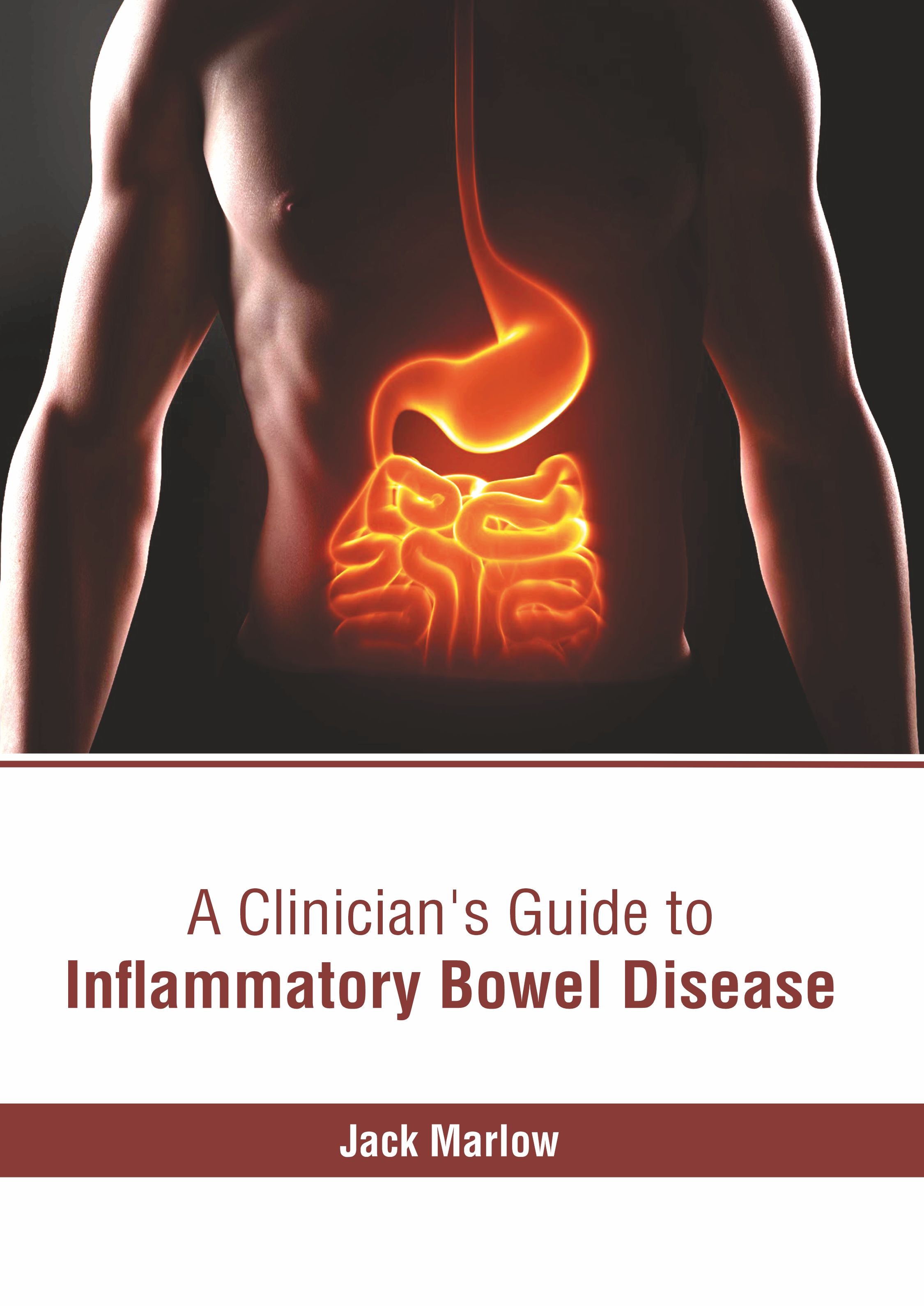 A Clinician's Guide to Inflammatory Bowel Disease - Prints Publications