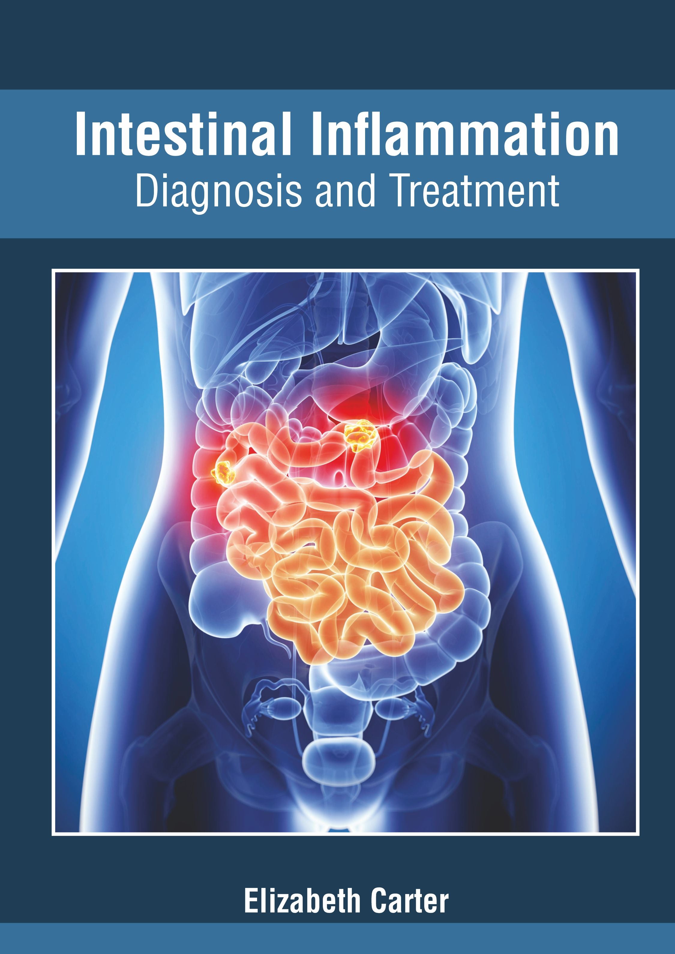 Intestinal Inflammation: Diagnosis and Treatment - Prints Publications
