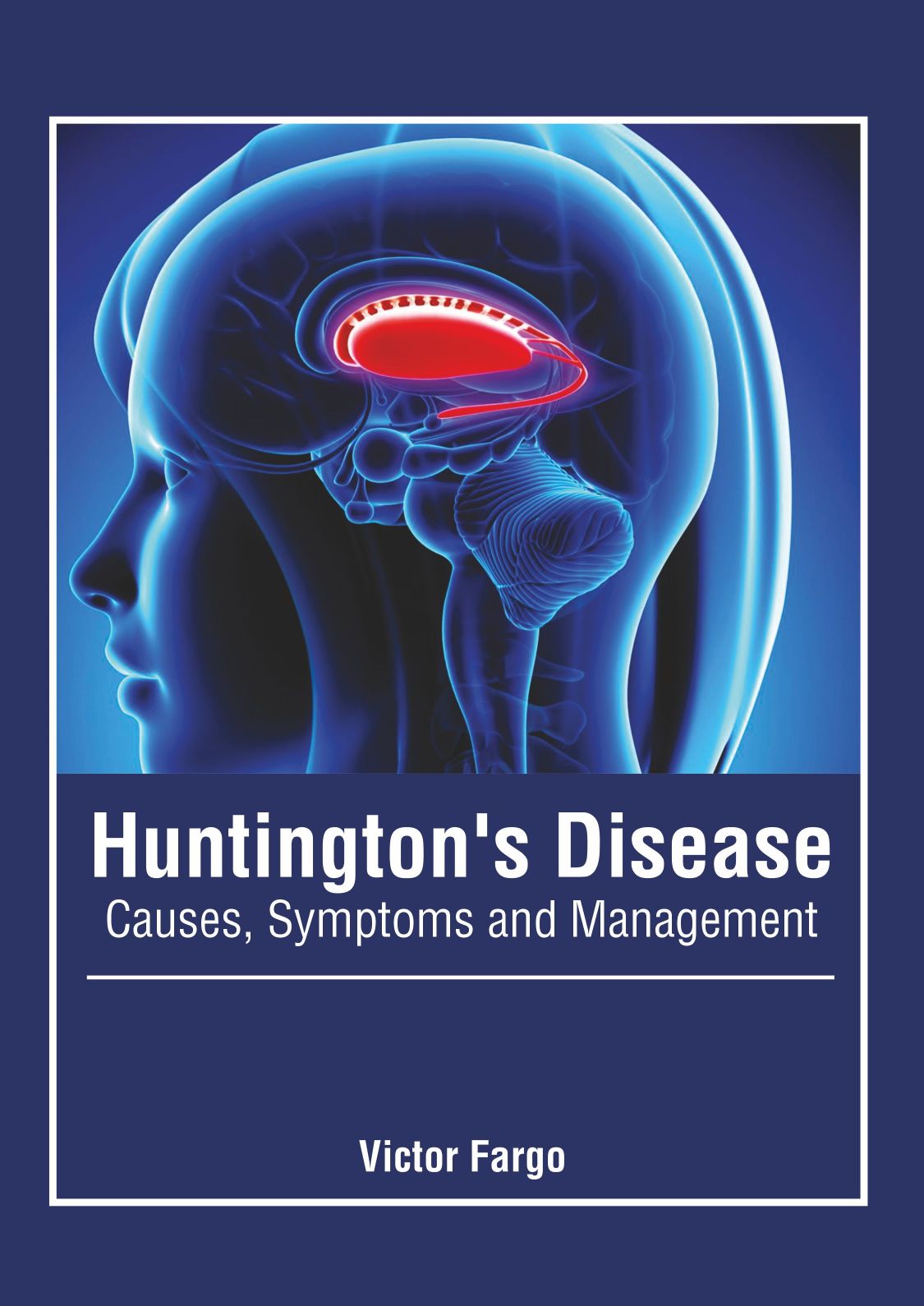 Huntington's Disease: Causes, Symptoms and Management - Prints Publications
