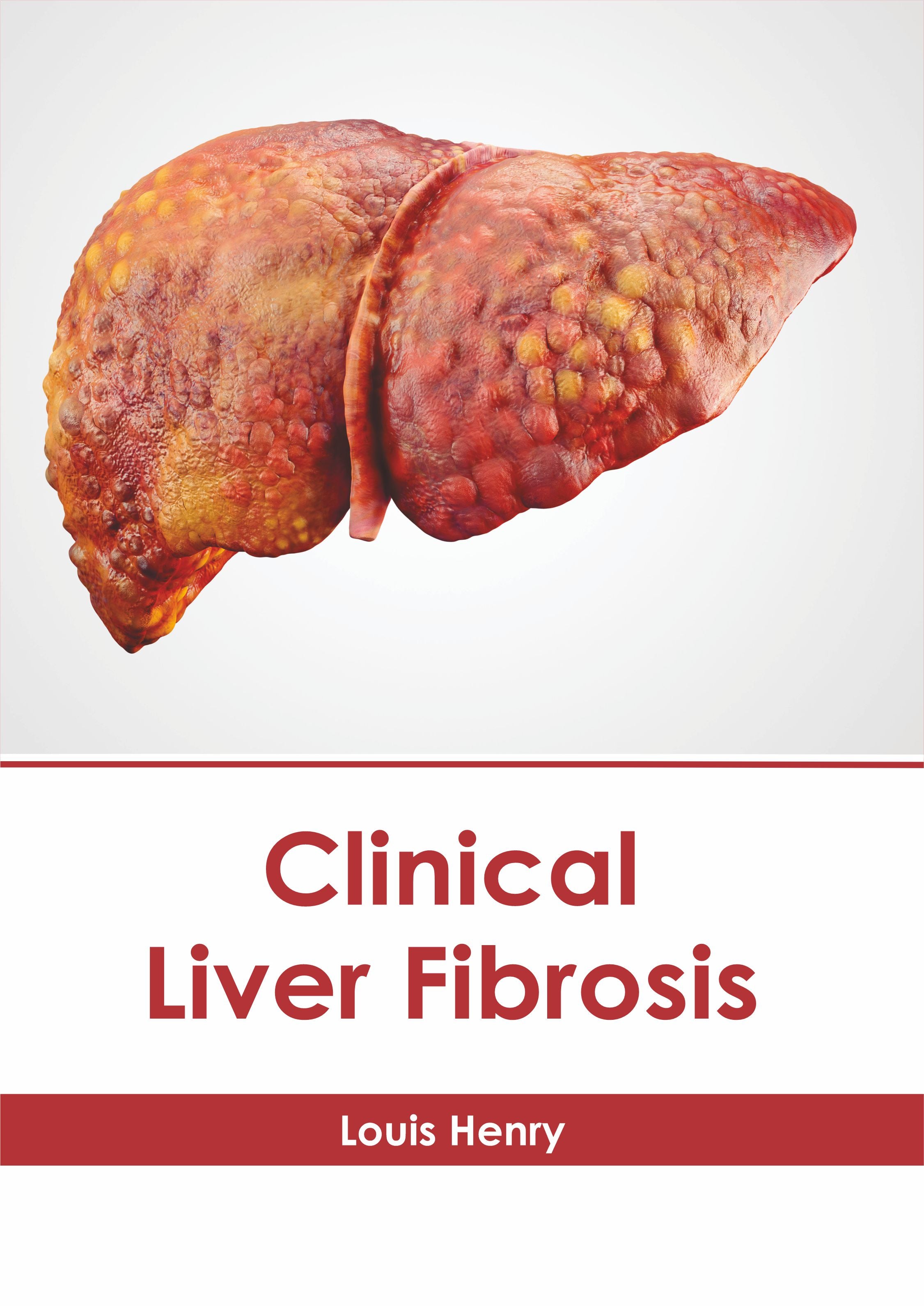 Clinical Liver Fibrosis - Prints Publications
