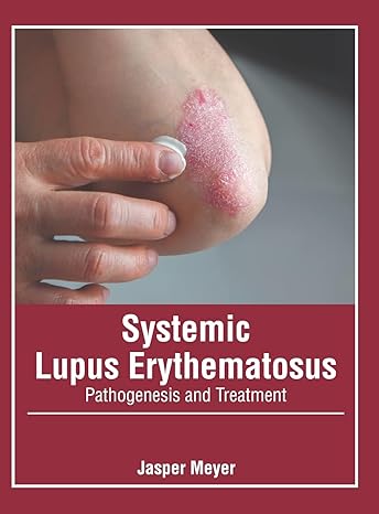 Systemic Lupus Erythematosus: Pathogenesis and Treatment - Prints Publications