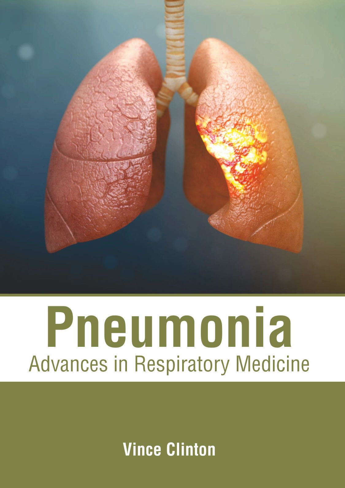 Pneumonia: Advances in Respiratory Medicine - Prints Publications