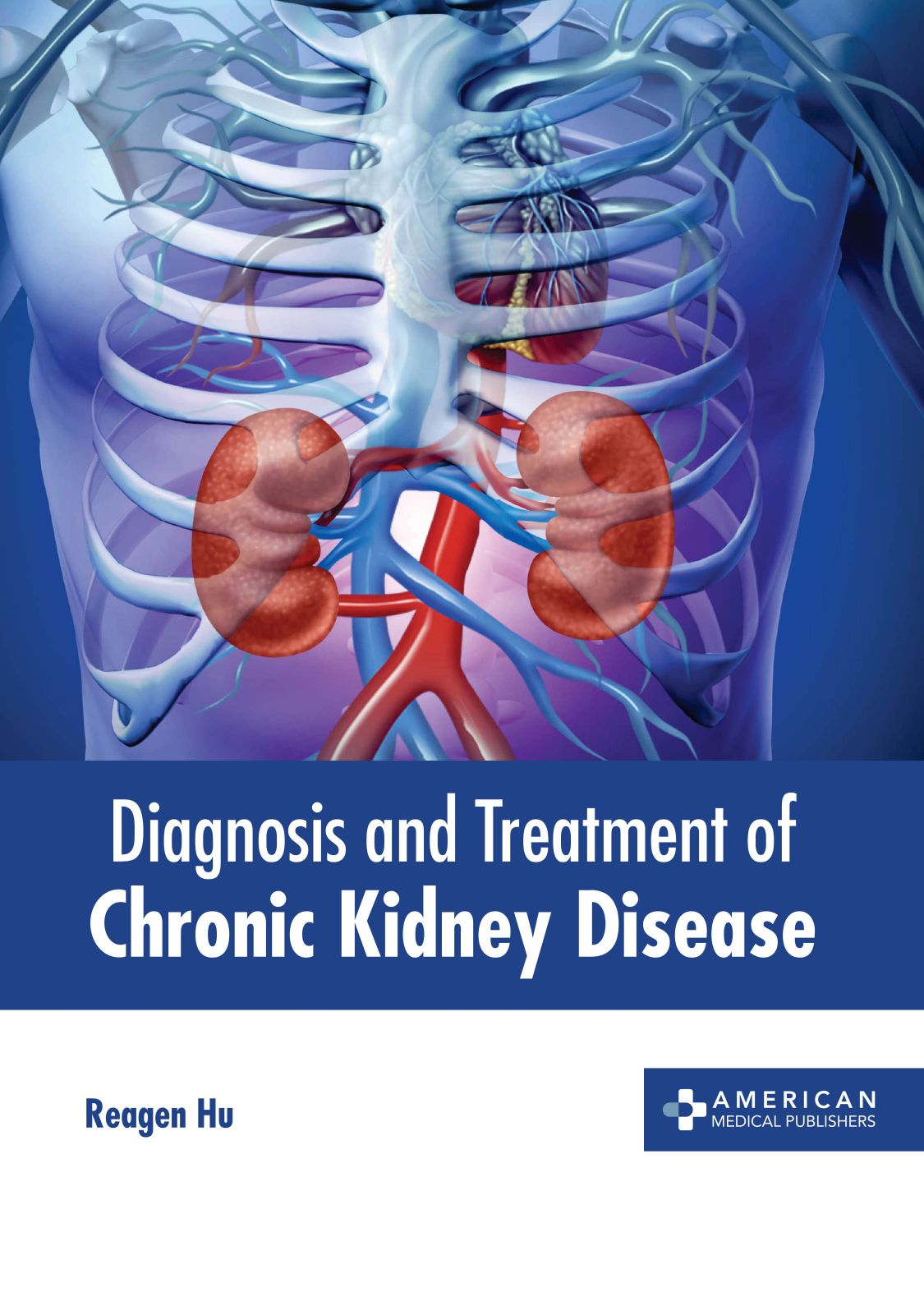 Diagnosis and Treatment of Chronic Kidney Disease - Prints Publications