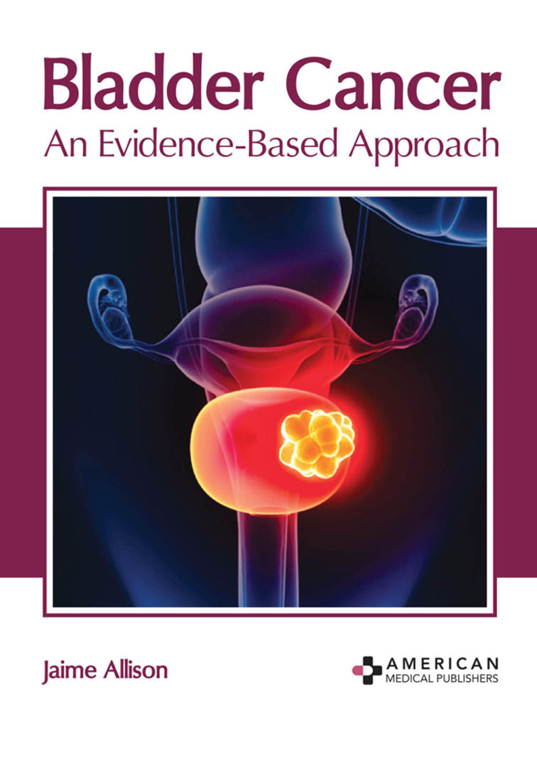 Bladder Cancer: An Evidence-Based Approach - Prints Publications