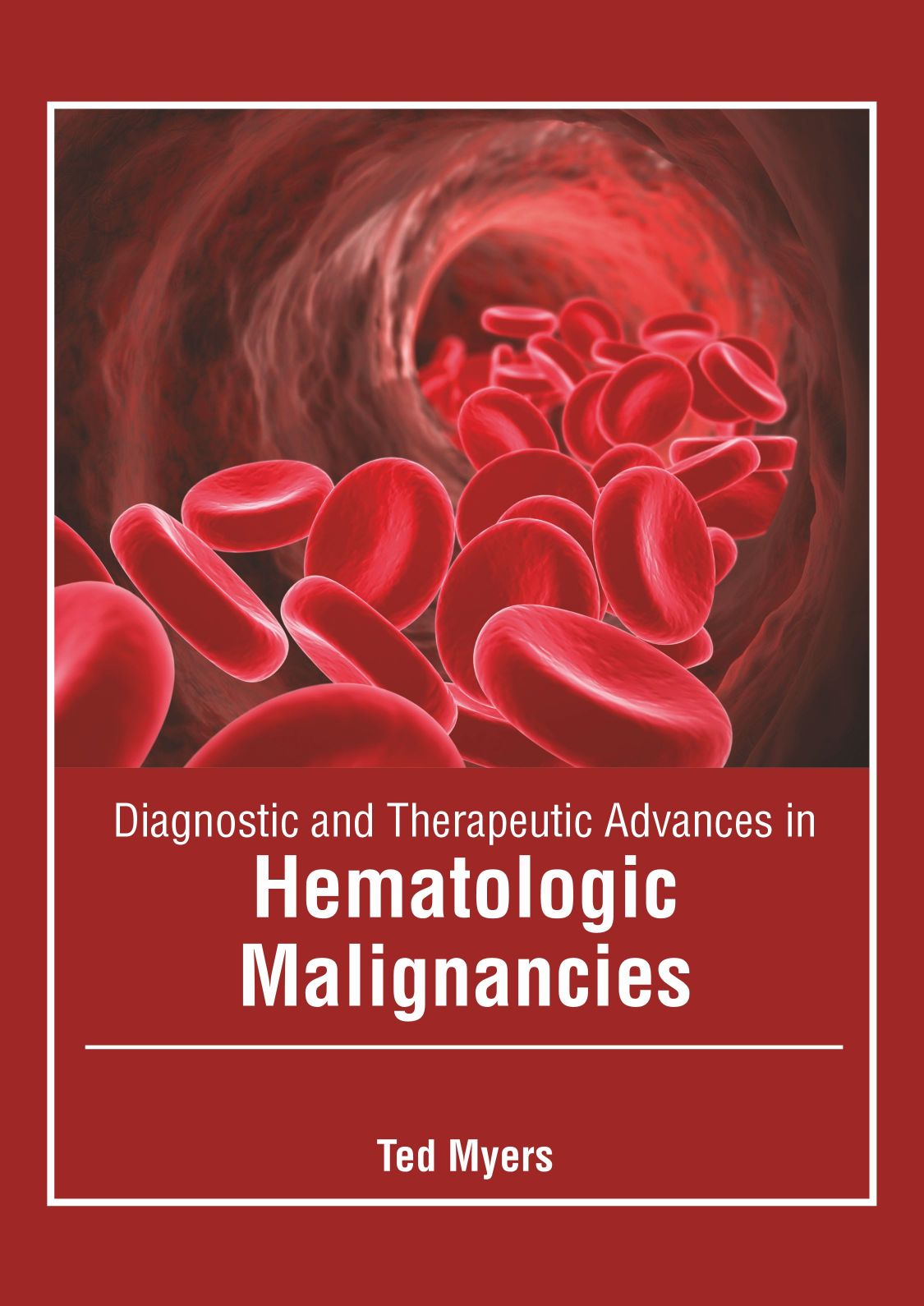 Diagnostic and Therapeutic Advances in Hematologic Malignancies - Prints Publications