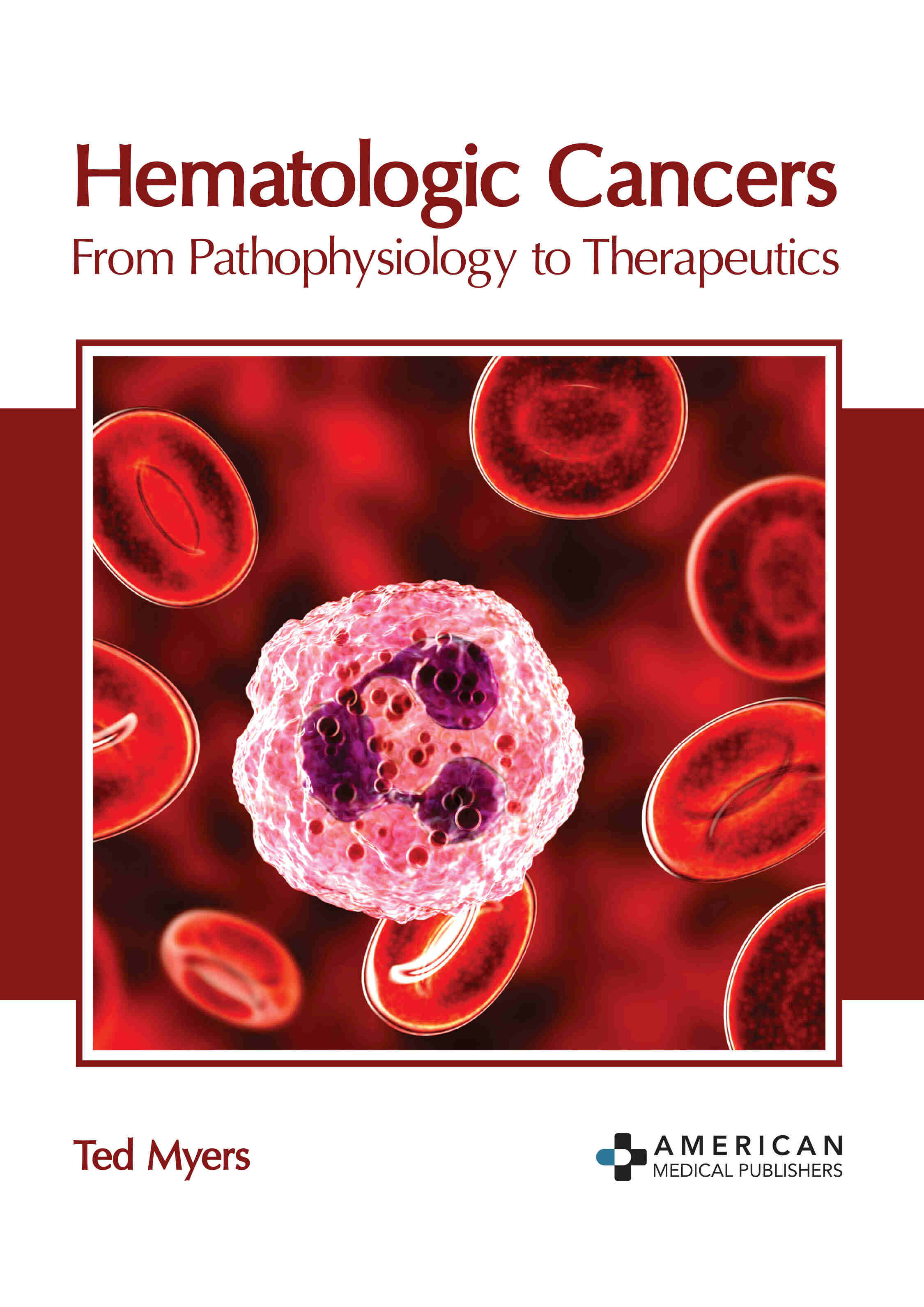 Hematologic Cancers: From Pathophysiology to Therapeutics - Prints Publications