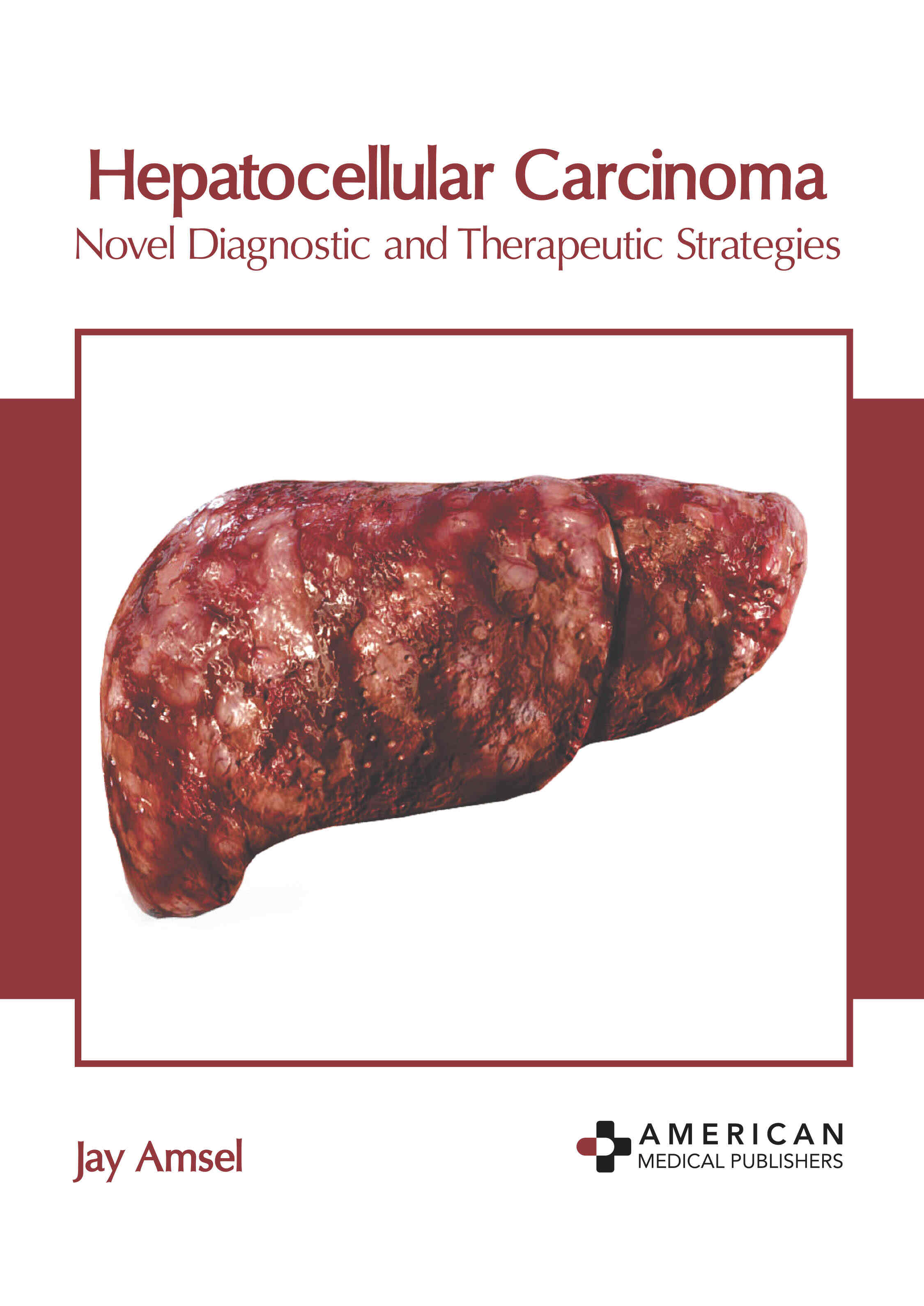 Hepatocellular Carcinoma: Novel Diagnostic and Therapeutic Strategies - Prints Publications