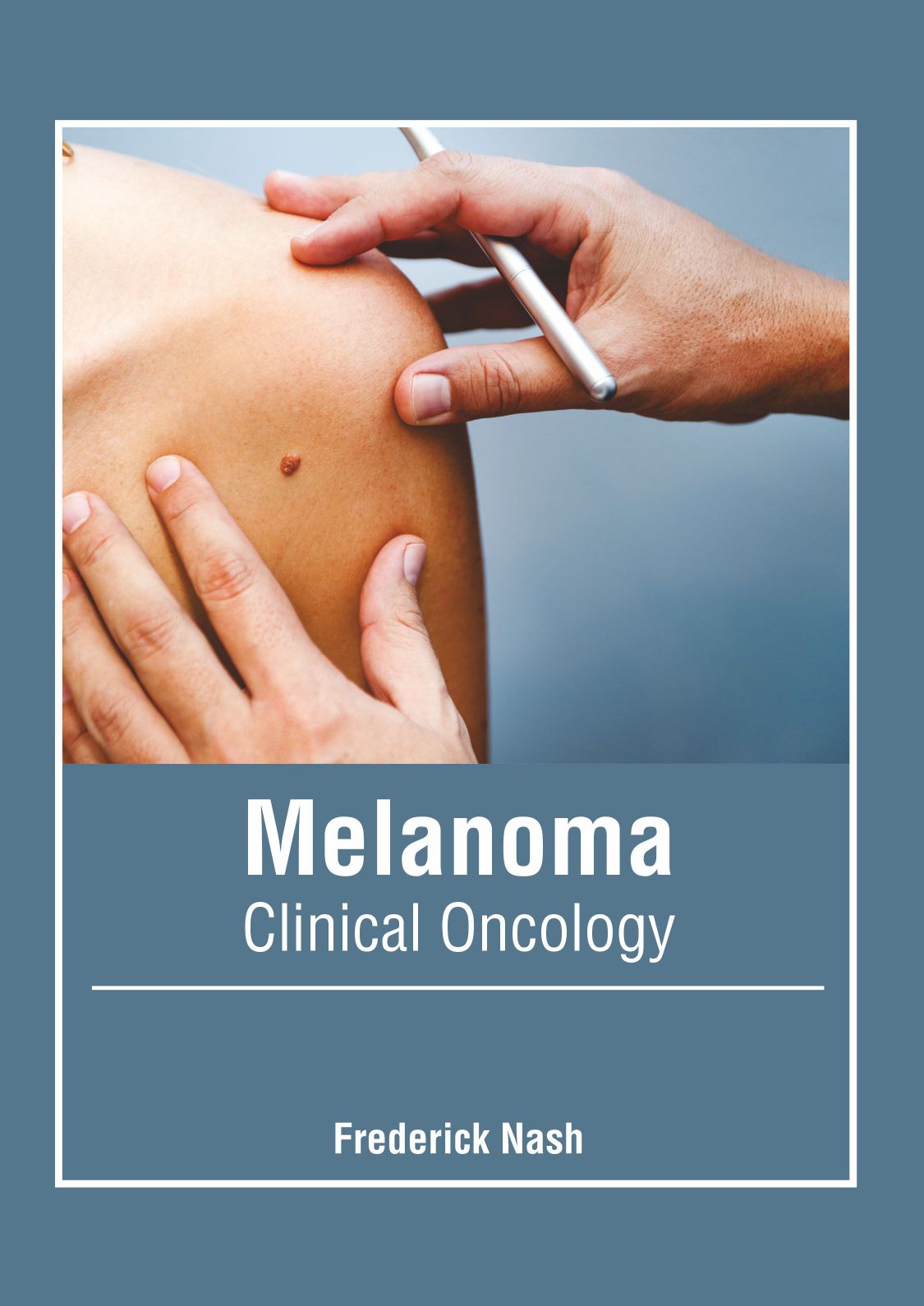 Melanoma: Clinical Oncology - Prints Publications