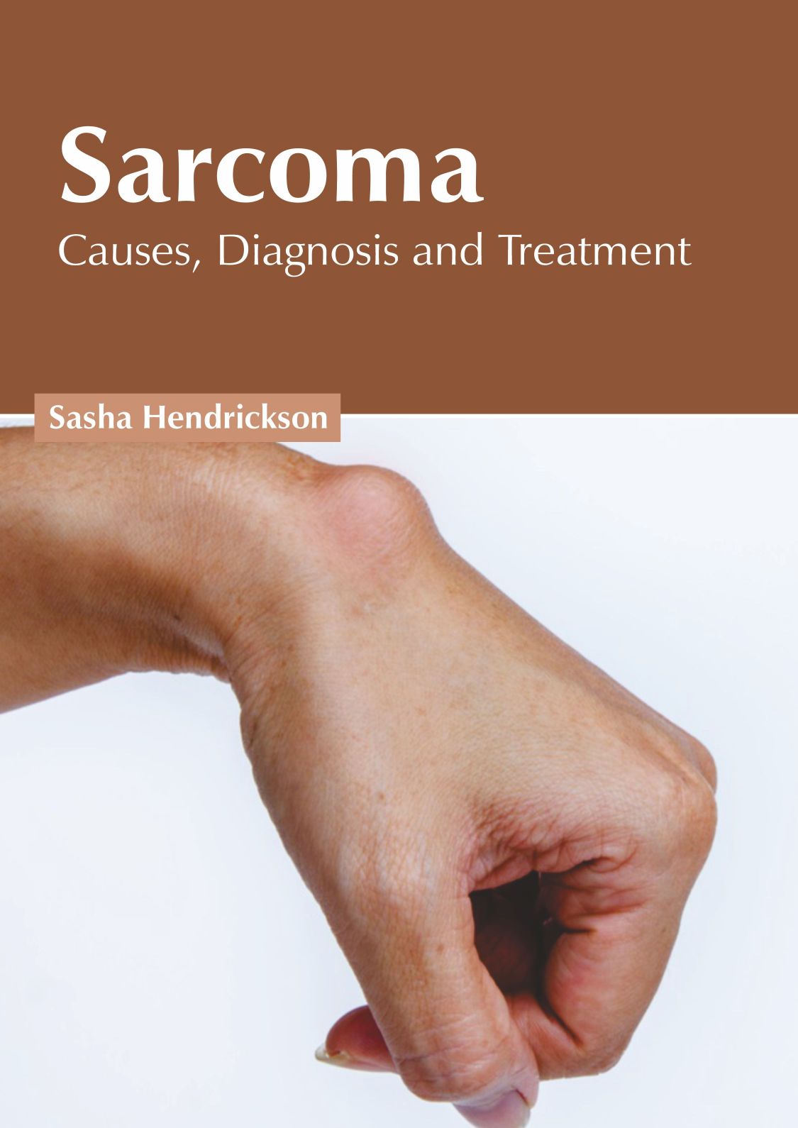 Sarcoma: Causes, Diagnosis and Treatment - Prints Publications