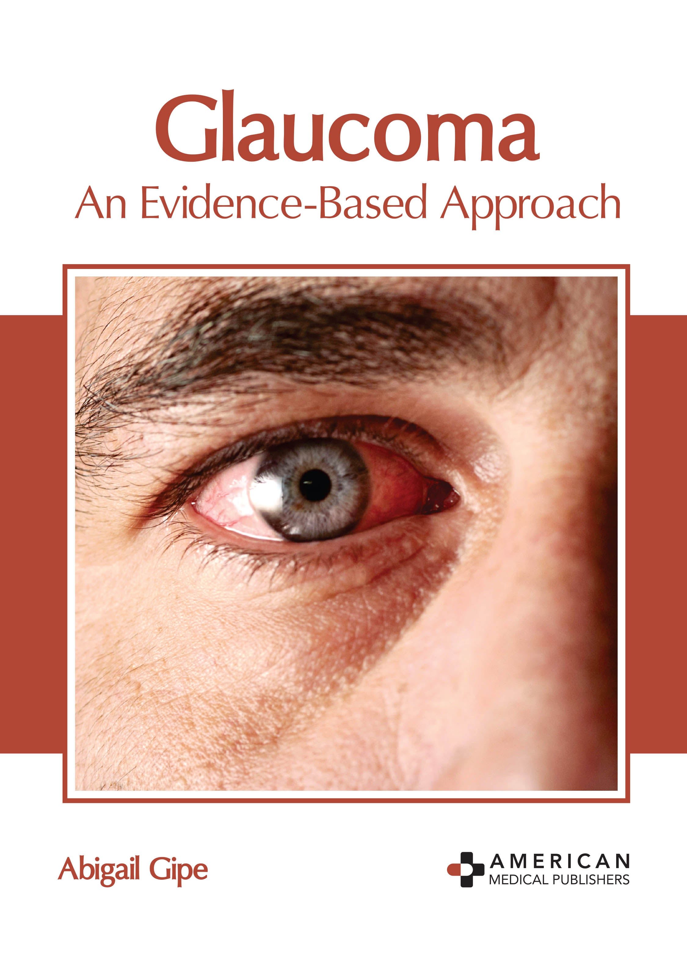 Glaucoma: An Evidence-Based Approach - Prints Publications