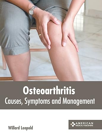 Osteoarthritis: Causes, Symptoms and Management - Prints Publications