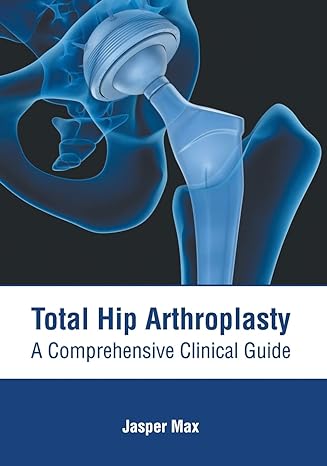 Total Hip Arthroplasty: A Comprehensive Clinical Guide - Prints Publications