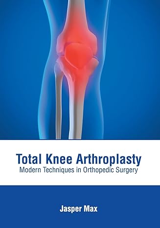 Total Knee Arthroplasty: Modern Techniques in Orthopedic Surgery - Prints Publications
