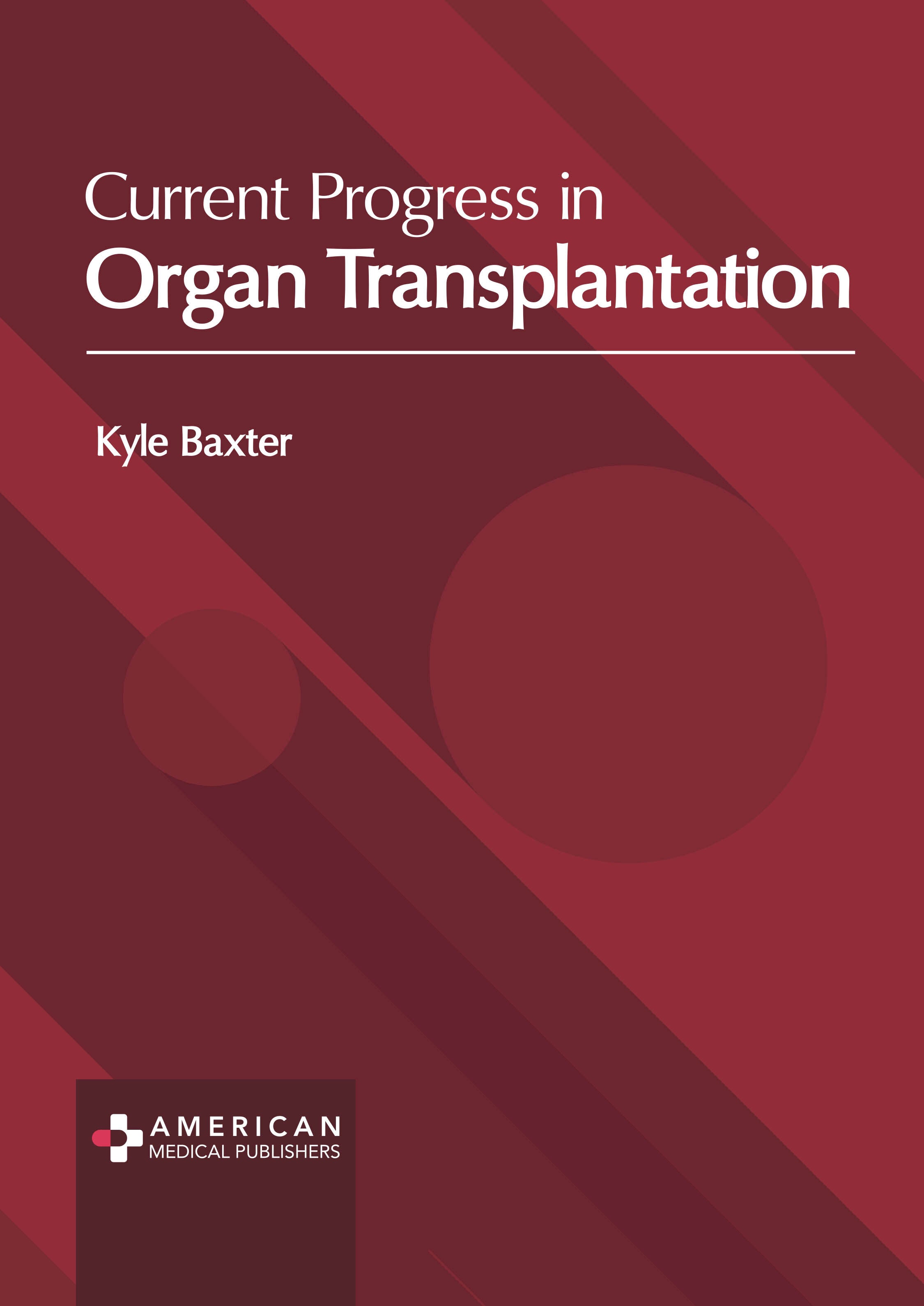 Current Progress in Organ Transplantation - Prints Publications