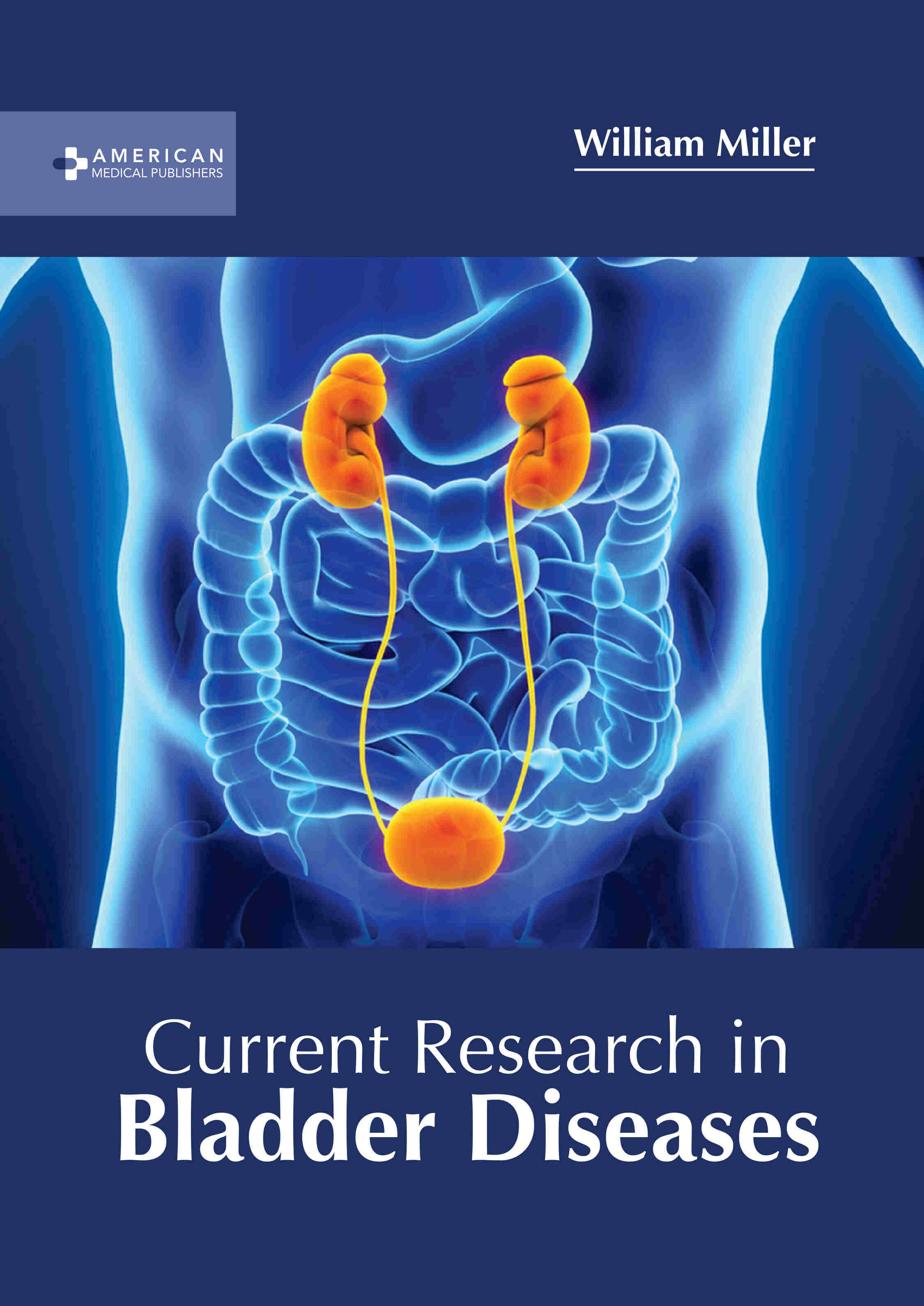 Current Research in Bladder Diseases - Prints Publications