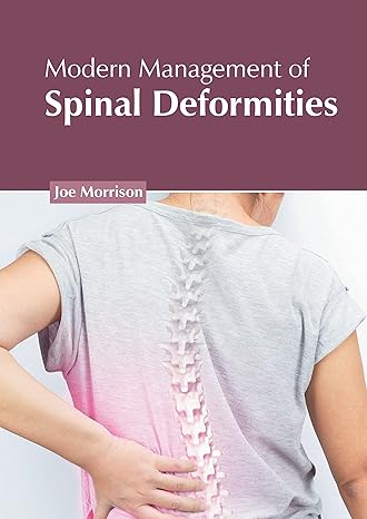 Modern Management of Spinal Deformities - Prints Publications