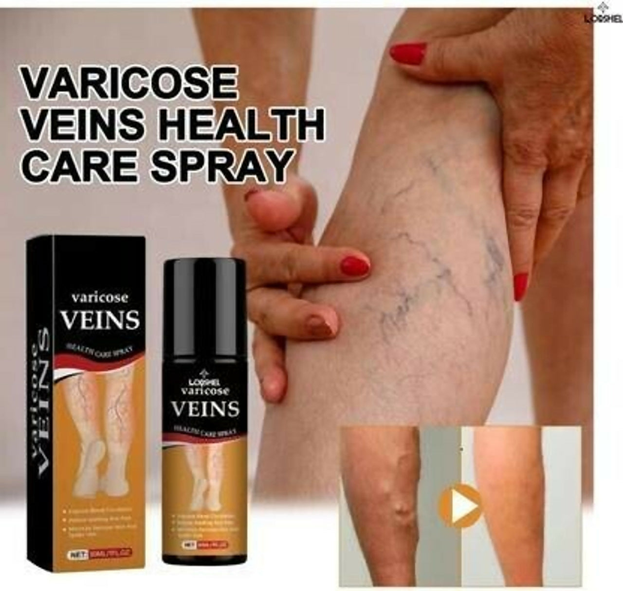 Fast-Acting Cooling Varicose Vein Relief Spray – Herbal Leg Pain & Swelling Treatment for Men & Women
