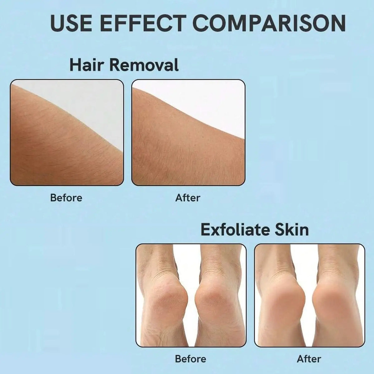 Nano Hair Remover For Arms Legs Back One Sided Skin Hair Remover (1 Pc) HP DD