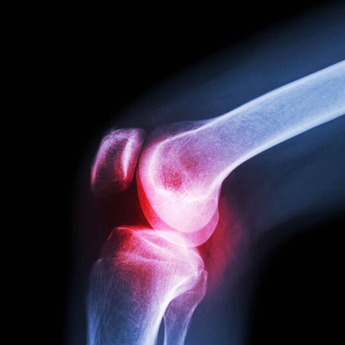 (Xl) Knee Cap For Knee Support HP DD