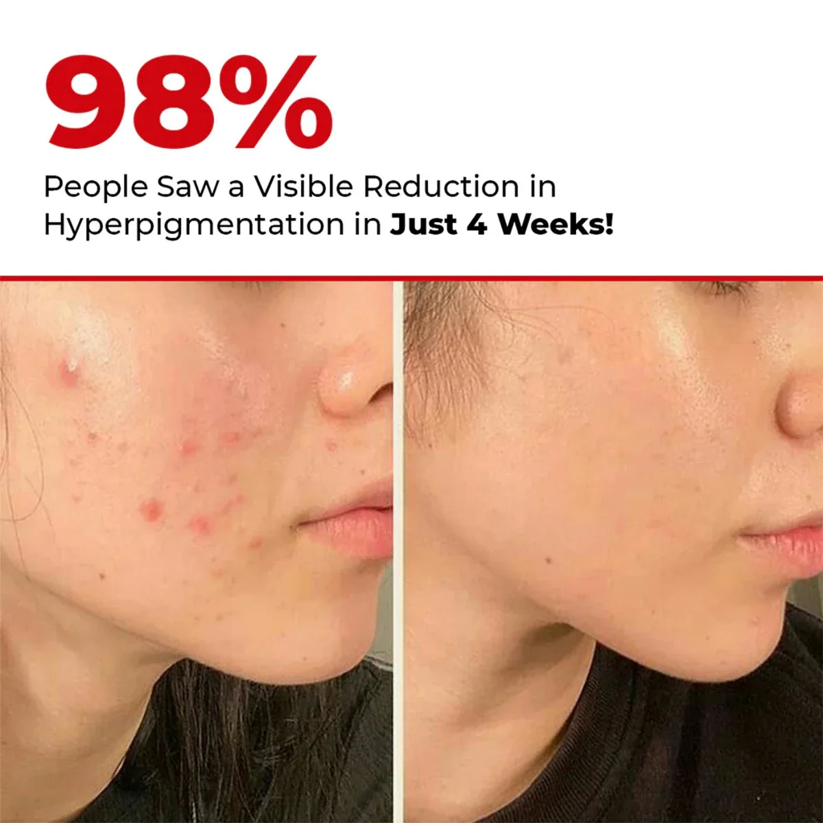 5 Antioxidant Serum Mini
