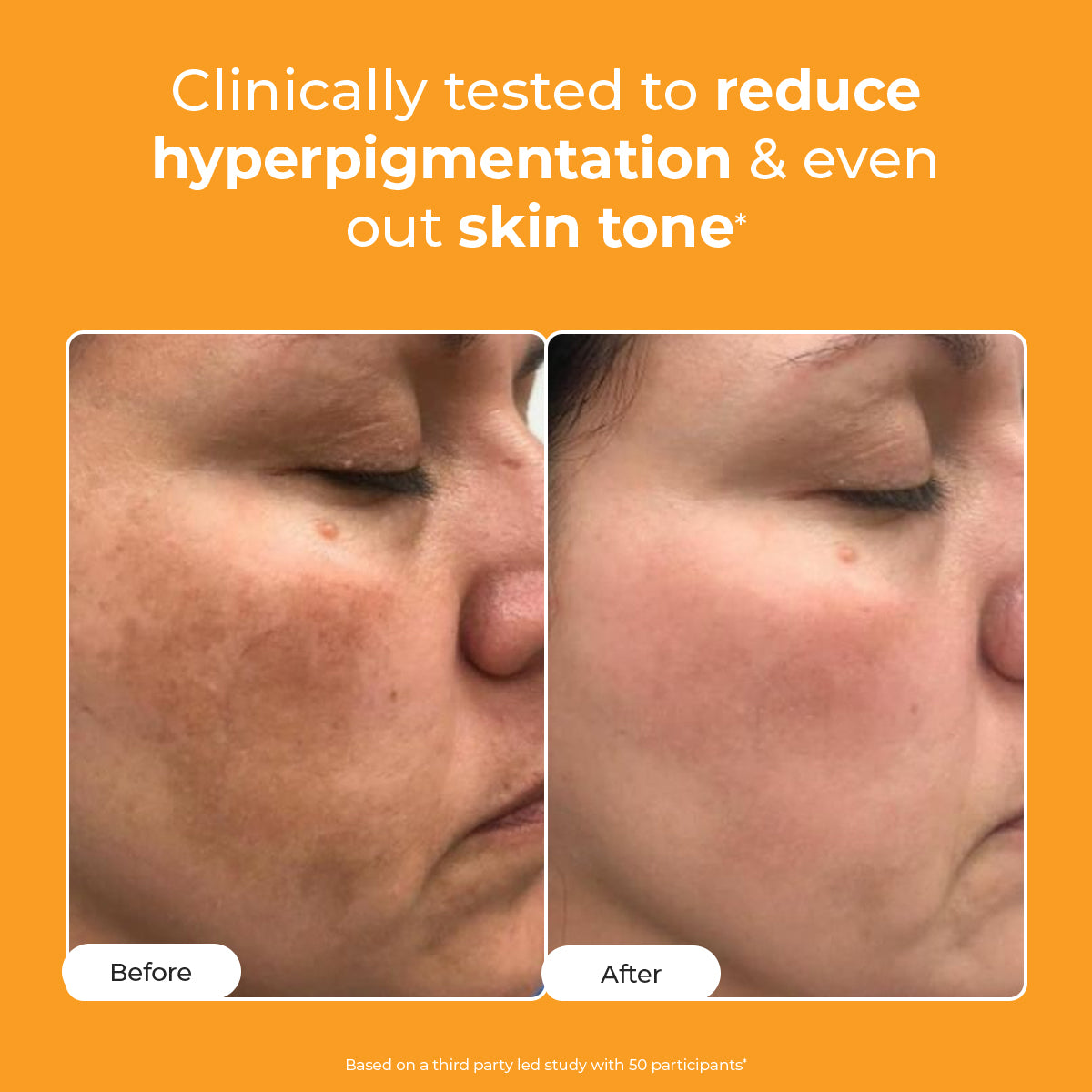 Conscious Chemist 10% Vitamin C Face Serum | For Glowing Skin (30 ml)