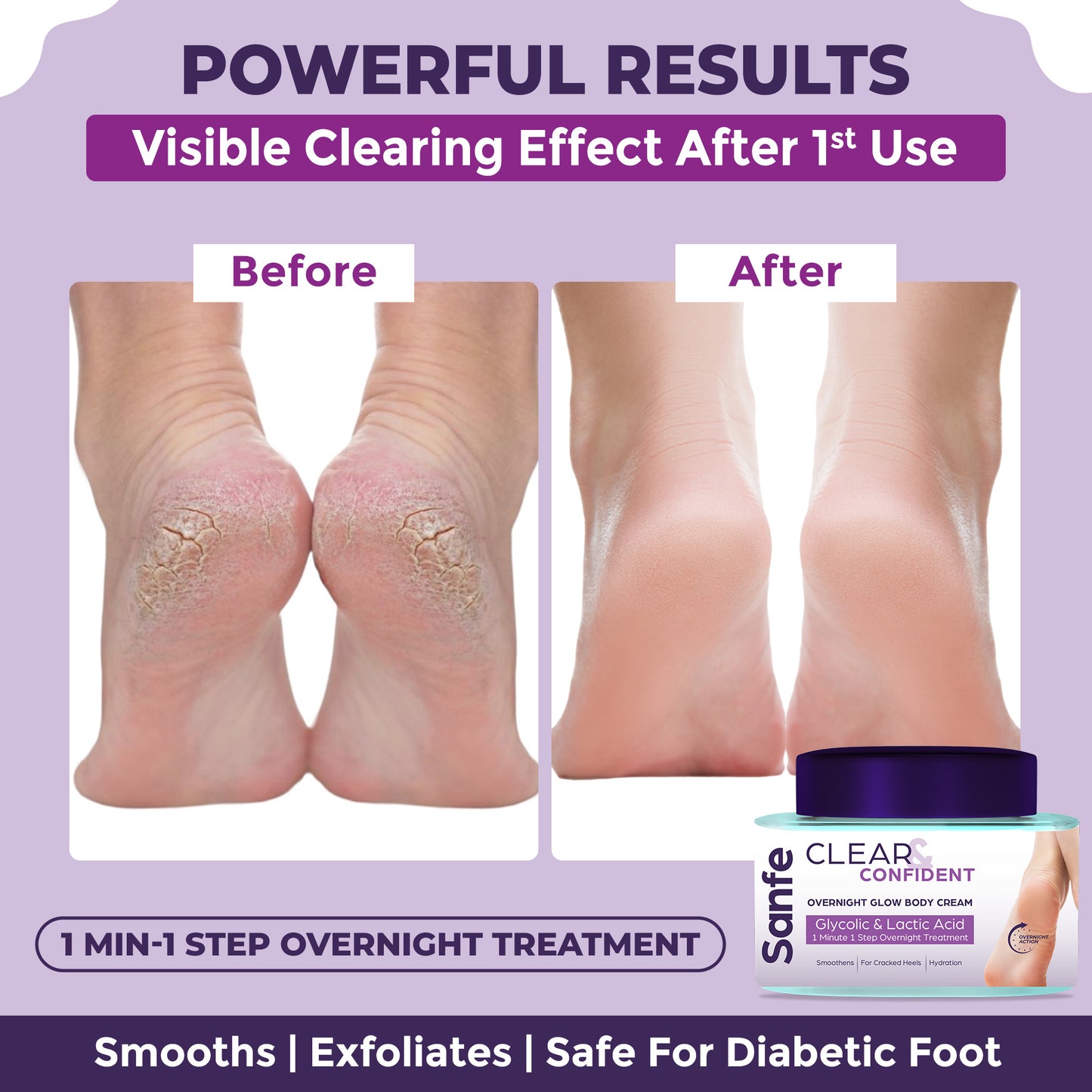 Sanfe Overnight Cream