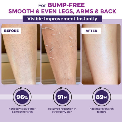 Sanfe Instant Bumps Eraser Exfolisting Gel For Rough & Bumpy Skin, Tan and Strawberry Legs Lactic Acid Bath to Remove Dirt, Dead Skin 200g for women for soft & bright skin