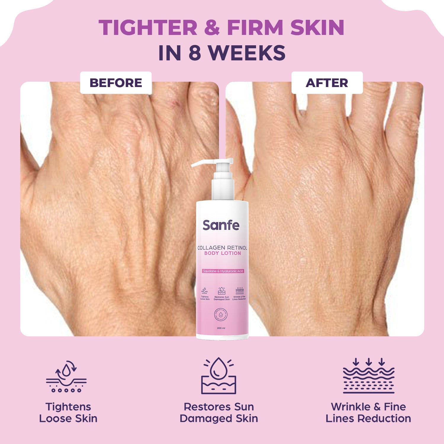 Sanfe Collagen Retinol Body Lotion For Skin Tightening, Firming, Stretch Marks, Wrinkles & Anti Aging Brighter, Soft Skin For Men & Women - 200ml