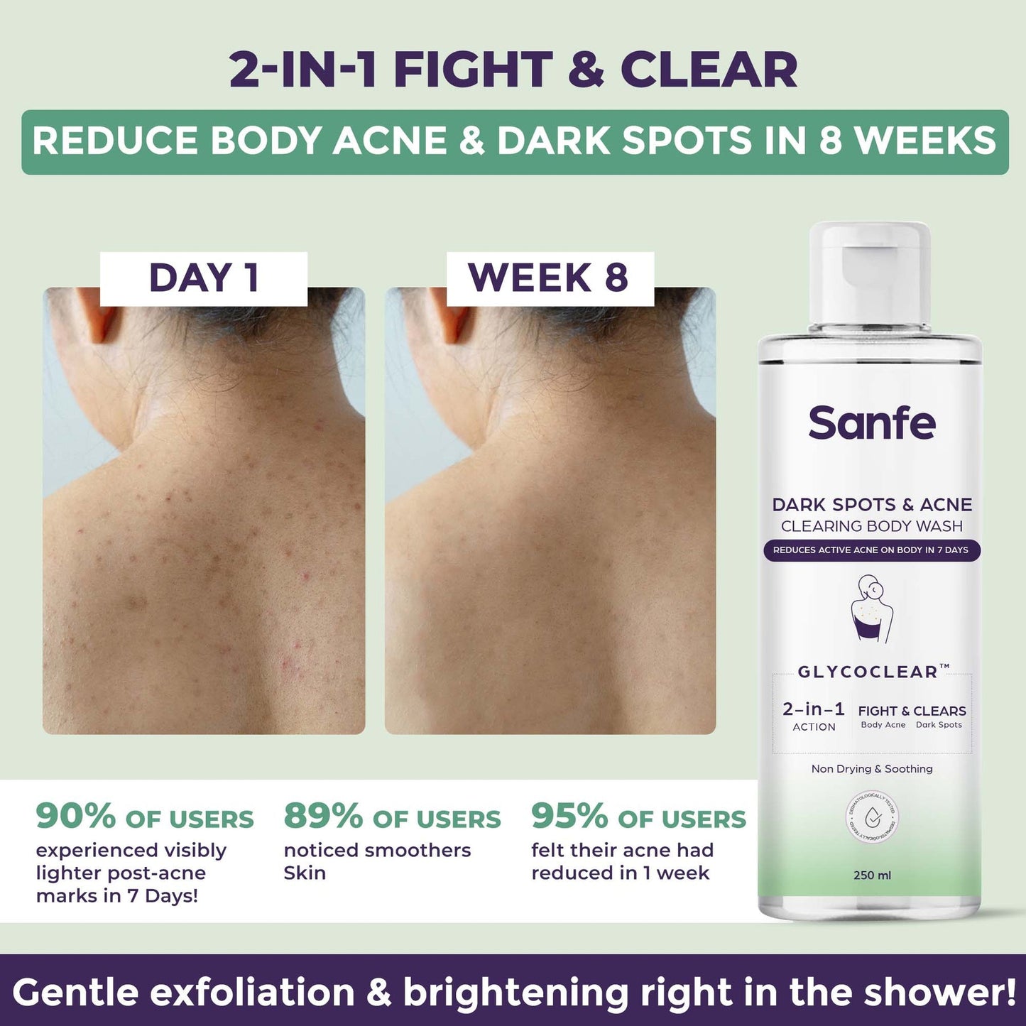 Sanfe Dark Spots & Acne Clearing Body Wash Prevents Body Acne, Bumpy Skin & Fades Dark Spots Salicylic Acid, Glycolic Acid & Tea Tree Non Drying Formula 250ml