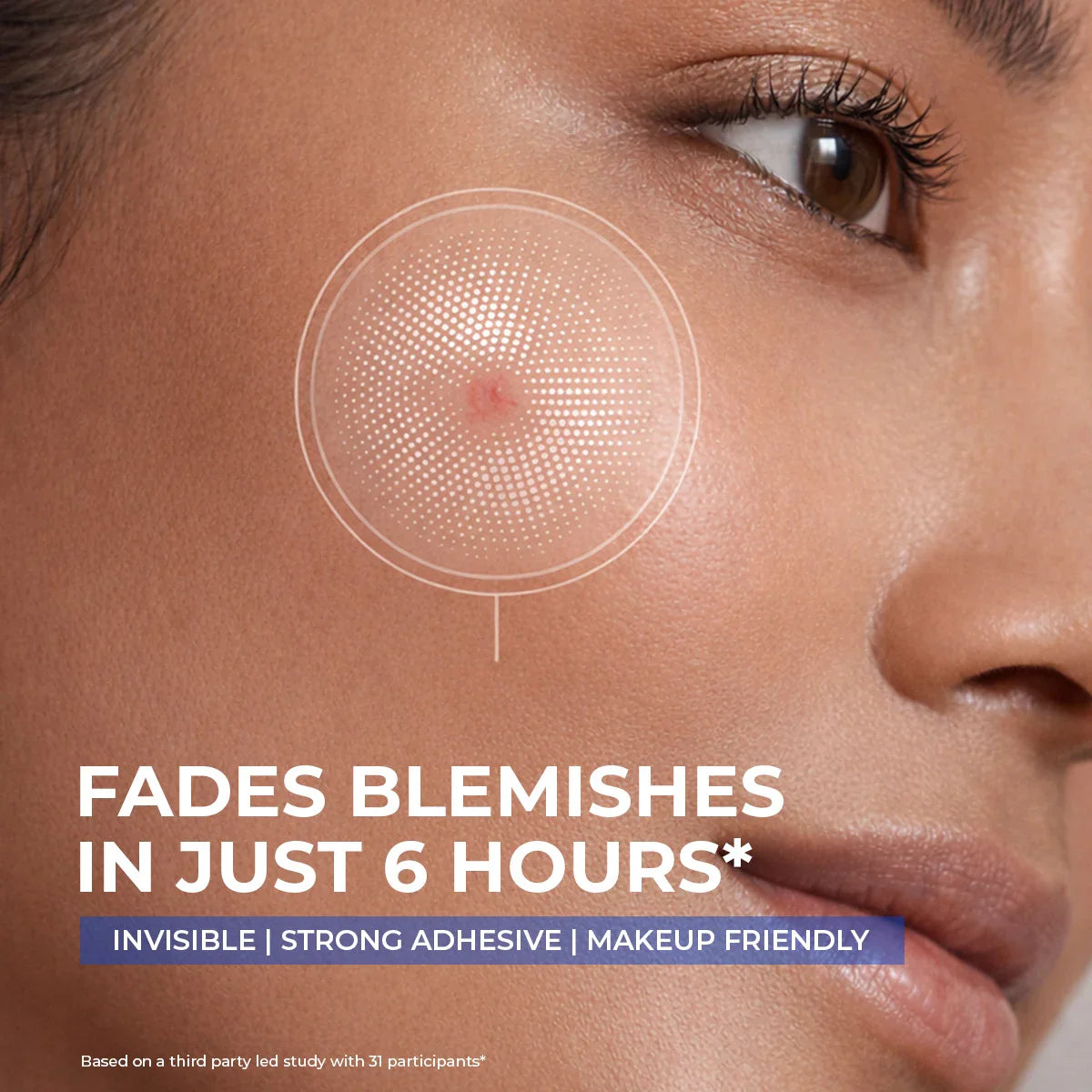 Microneedle Patch For Dark Spot Removal | 4 Patches