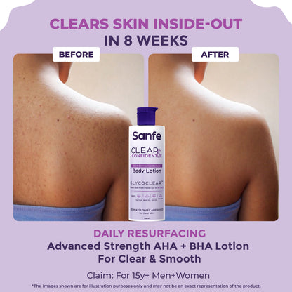 Sanfe Clear & Confident Glycolic Acid Body Lotion