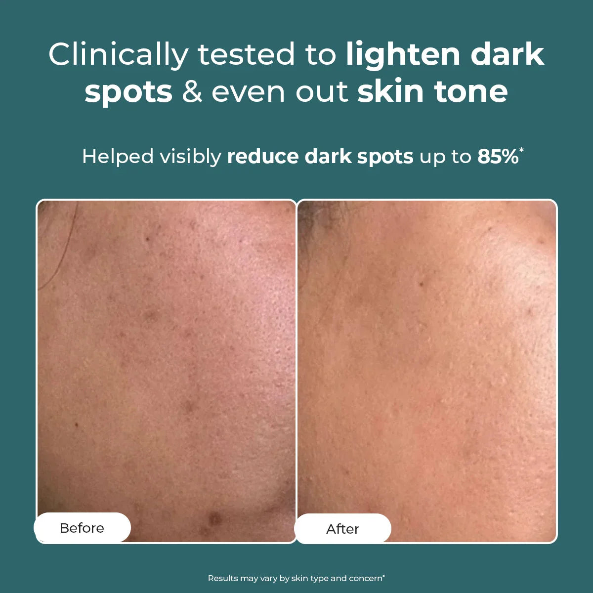 Trubiom Pigmentation Corrector Gel Cream