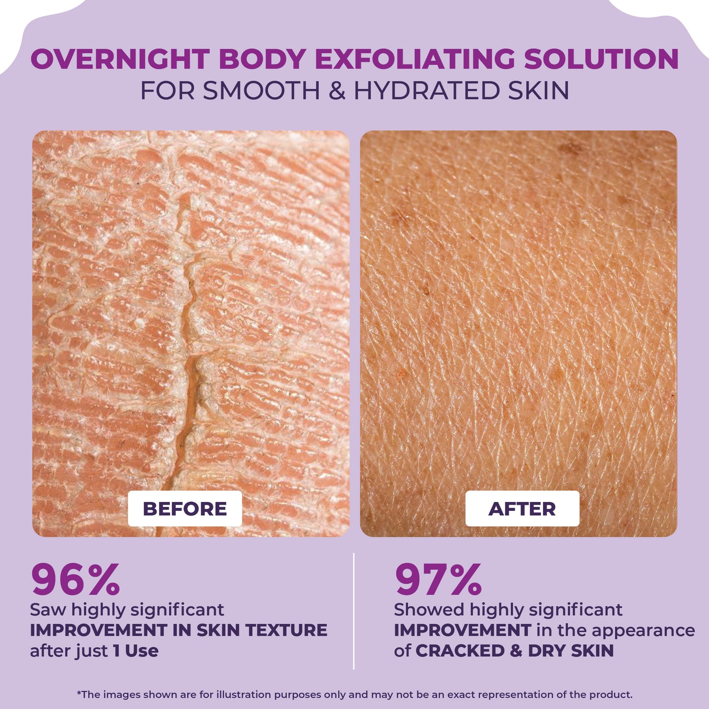 Sanfe Overnight Cream