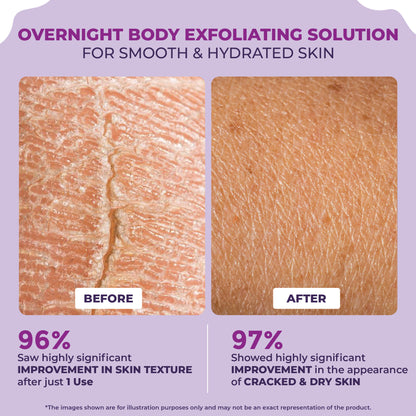 Sanfe Overnight Cream